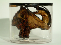 GC.9173
<br/>
Veins and arteries of the head and neck
<br/>
<em>Struthers, John (1823-1899)</em>
